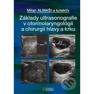 Základy ultrasonografie v otorinolaryngológii a chirurgii hlavy a krku - Milan Almaši
