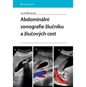 E-kniha Abdominální sonografie žlučníku a žlučových cest - Iva Hoffmanová