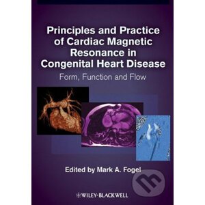 Principles and Practice of Cardiac Magnetic Resonance in Congenital Heart Disease - Mark A. Fogel