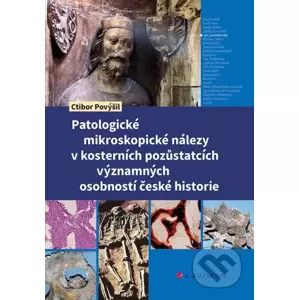 E-kniha Patologické mikroskopické nálezy v kosterních pozůstatcích významných osobností české historie - Ctibor Povýšil