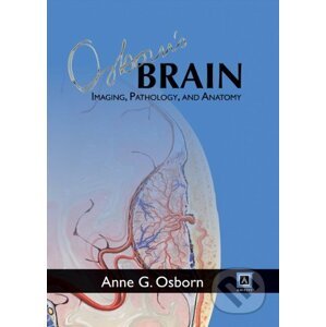 Osborn's Brain: Imaging, Pathology, and Anatomy - Anne G. Osborn