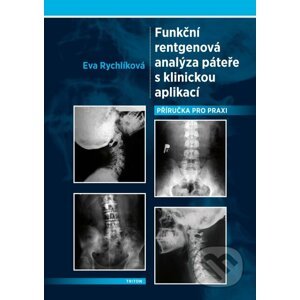 Funkční rentgenová analýza páteře s klinickou aplikací - Eva Rychlíková