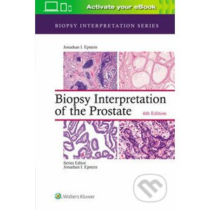 Biopsy Interpretation of the Prostate - Jonathan I. Epstein