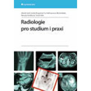 Radiologie pro studium i praxi - Zdeněk Seidl a kolektív