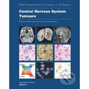WHO Classification of Tumours: Central Nervous System Tumours - World Health Organization