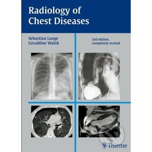 Radiology of Chest Diseases - Sebastian Lange