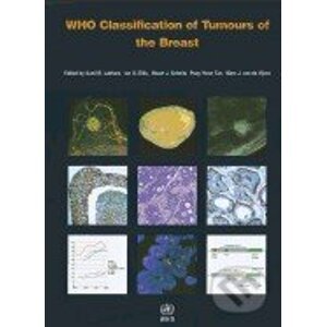 Who Classification of Tumours of the Breast - S.R. Lakhani