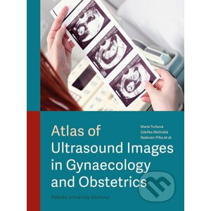 Atlas of Ultrasound Images in Gynaecology and Obstetrics - Marie Turková, Zdeňka Malínská, Radovan Pilka, kolektiv autorů