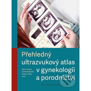 Přehledný ultrazvukový atlas v gynekologii a porodnictví - Marie Turková, Zdeňka Malínská, Radovan Pilka, kolektiv autorů