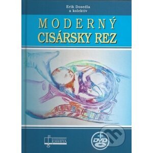 Moderný cisársky rez - Erik Dosedla, kolektív autorov