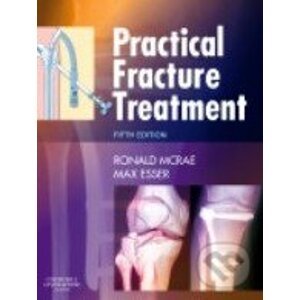 Practical Fracture Treatment - Churchill Livingstone