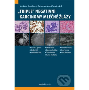„Triple“ negativní karcinomy mléčné žlázy - Markéta Kolečková, Katherine Vomáčková