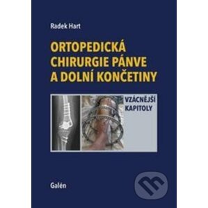 Ortopedická chirurgie pánve a dolní končetiny - Radek Hart