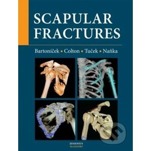Scapular fractures - Jan Bartoníček, Michal Tuček, Ondřej Naňka