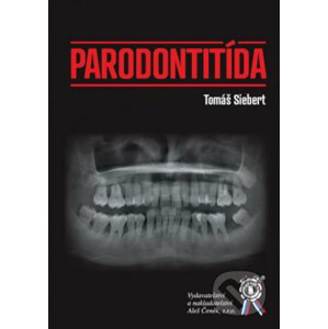 Parodontitída - Tomáš Siebert
