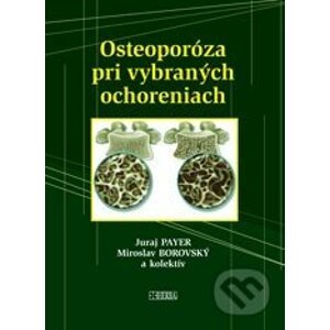 Osteoporóza pri vybraných ochoreniach - Juraj Payer, Miroslav Borovský a kolektív
