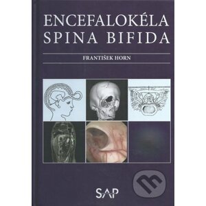 Encefalokéla spina bifida - František Horn