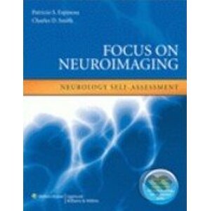 Focus on Neuroimaging - Patricio S. Espinosa
