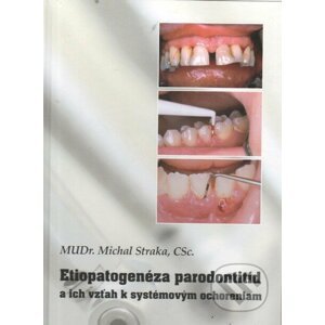 Etiopatogenéza parodontitíd a ich vzťah k systémovým ochoreniam - Michal Straka