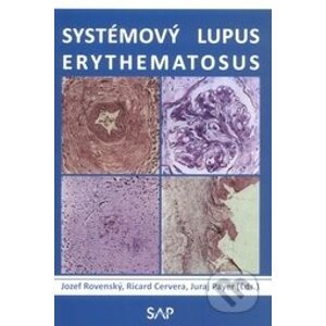 Systémový lupus erythematosus - Slovak Academic Press