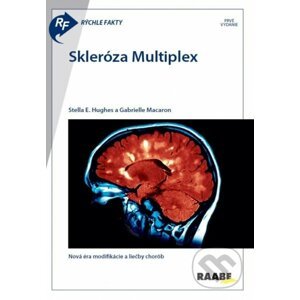 Rýchle fakty: Skleróza multiplex - Raabe