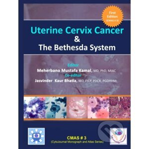Uterine Cervix Cancer The Bethesda System - Meherbano Mustafa Kamal