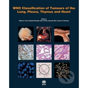 Who Classification of Tumours of the Lung, Pleura, Thymus and Heart - International Agency for Research on Cancer
