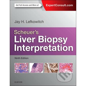 Scheuer's Liver Biopsy Interpretation - Jay Lefkowitch