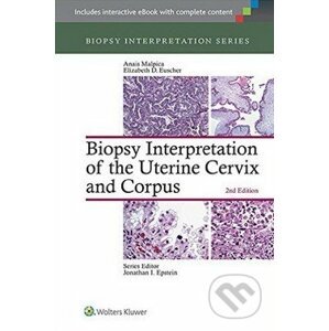 Biopsy Interpretation of the Uterine Cervix and Corpus - Anais Malpica