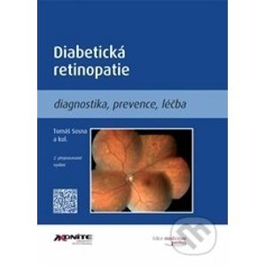 Diabetická retinopatie - Tomáš Sosna a kolektív