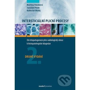 Intersticiální plicní procesy - Martina Vašáková, Jaroslav Poláik