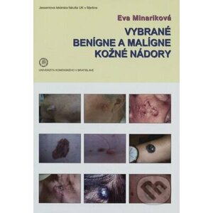 Vybrané benígne a malígne kožné nádory - Eva Mináriková