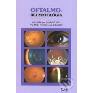 Oftalmo-reumatológia - Igor Kozák, Jozef Rovenský