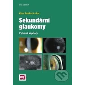 Sekundární glaukomy - Klára Samková a kolektív