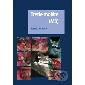 Tretie moláre (M3) - Dušan Hirjak, Vladimír Machoň