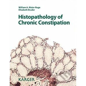 Histopathology of Chronic Constipation - Elisabeth Bruder a kol.