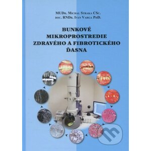 Bunkové mikroprostredie zdravého a fibrotického ďasna - Michal Straka