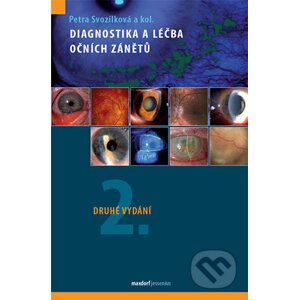 Diagnostika a léčba očních zánětů - Petra Svozílková