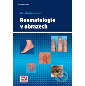 Revmatologie v obrazech - Marta Olejárová