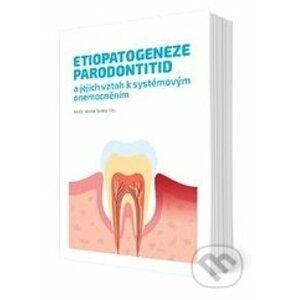 Etiopatogeneze parodontitid a jejich vztah k systémovým onemocněním - Michal Straka