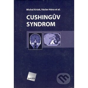 Cushingův syndrom - Michal Kršek, Václav Hána