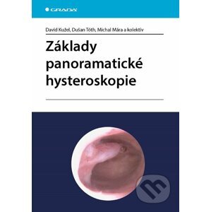 Základy panoramatické hysteroskopie - David Kužel, Dušan Tóth, Michal Mára a kolektiv