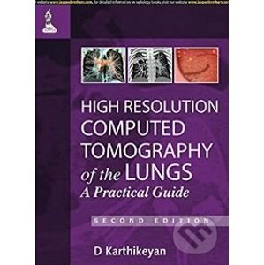 High Resolution Computed Tomography of the Lungs - D. Karthikeyan