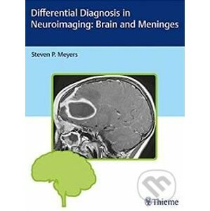 Differential Diagnosis in Neuroimaging - Steven P. Meyers