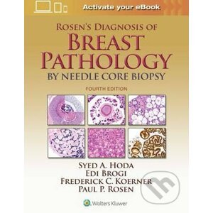 Rosen's Diagnosis of Breast Pathology by Needle Core Biopsy - Syed A. Hoda a kol.
