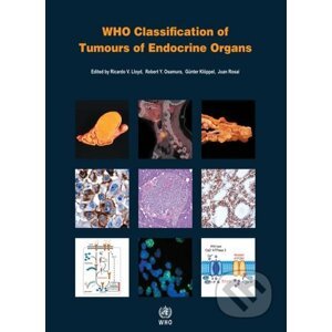 WHO Classification of Tumours of Endocrine Organs - World Health Organization