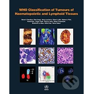 WHO Classification of Tumours of Haematopoietic and Lymphoid Tissues - World Health Organization
