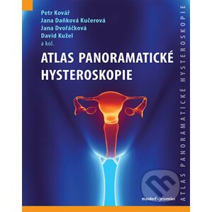 Atlas panoramatické hysteroskopie - kolektív