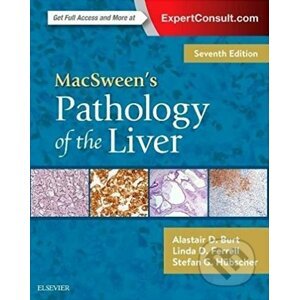 MacSween's Pathology of the Liver - Alastair D. Burt, Linda D. Ferrell, Stefan G. Hubscher