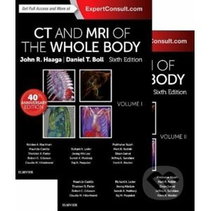 CT and MRI of the Whole Bod, (2 Volume Set) - John R. Haaga, Daniel Boll